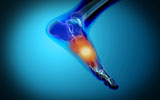 STK700056H
Conceptual image of pain in human foot.