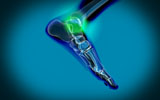 STK700057H
X-ray view of pain in human foot.