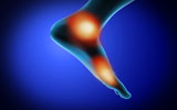 STK700061H
Conceptual image of muscle cramp and pain in human foot.