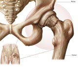 STK700177H
Anatomy of hip fracture.