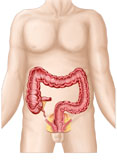 STK700182H
Sectional view of large intestine.