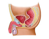 STK700189H
Medical illustration of a rectourethral fistula.