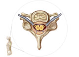 STK700240H
Anatomy of human vertebra.