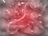 STK700318H
Microscopic view of hookworm.